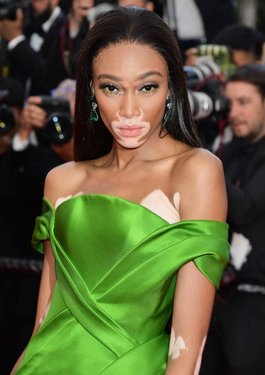 Winnie Harlow.jpeg