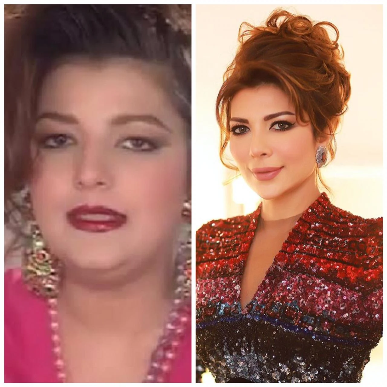 صور اصالة قبل وبعد