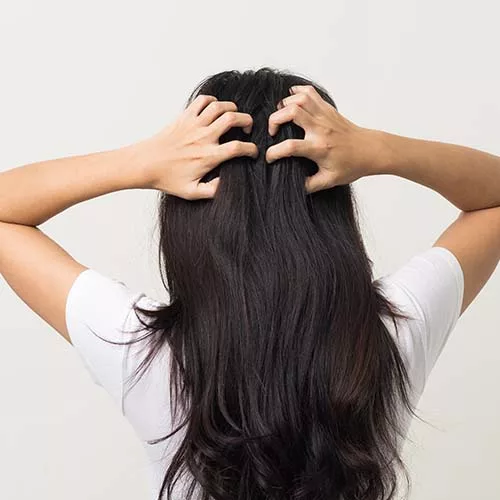 المصادر الشائعة خلف فطريات الشعر!