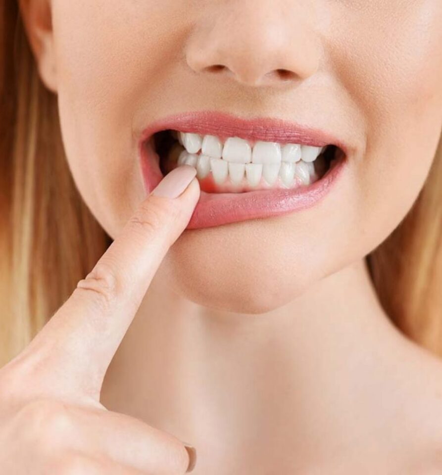 اكتشفي أحسن الطرق لعلاج التهاب اللثة وانتفاخها في المنزل!