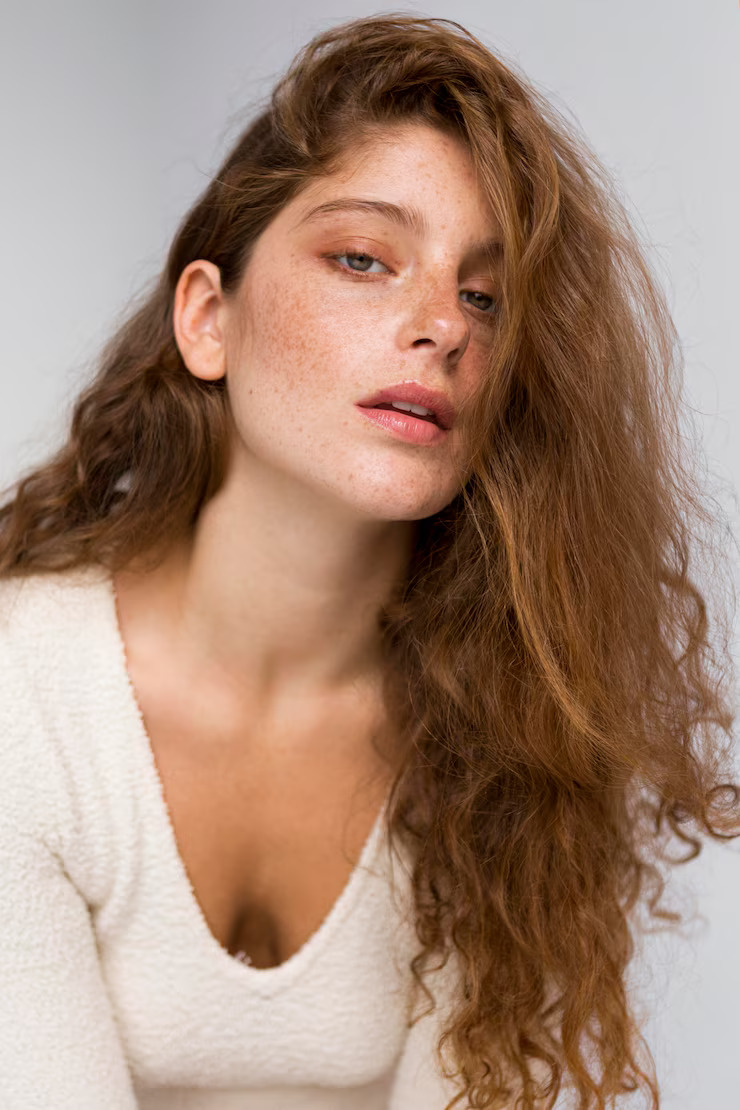 اسباب النمش: بين الوراثة والعوامل البيئية