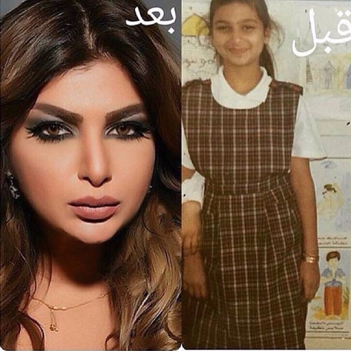 صورة أميرة محمد قبل وبعد