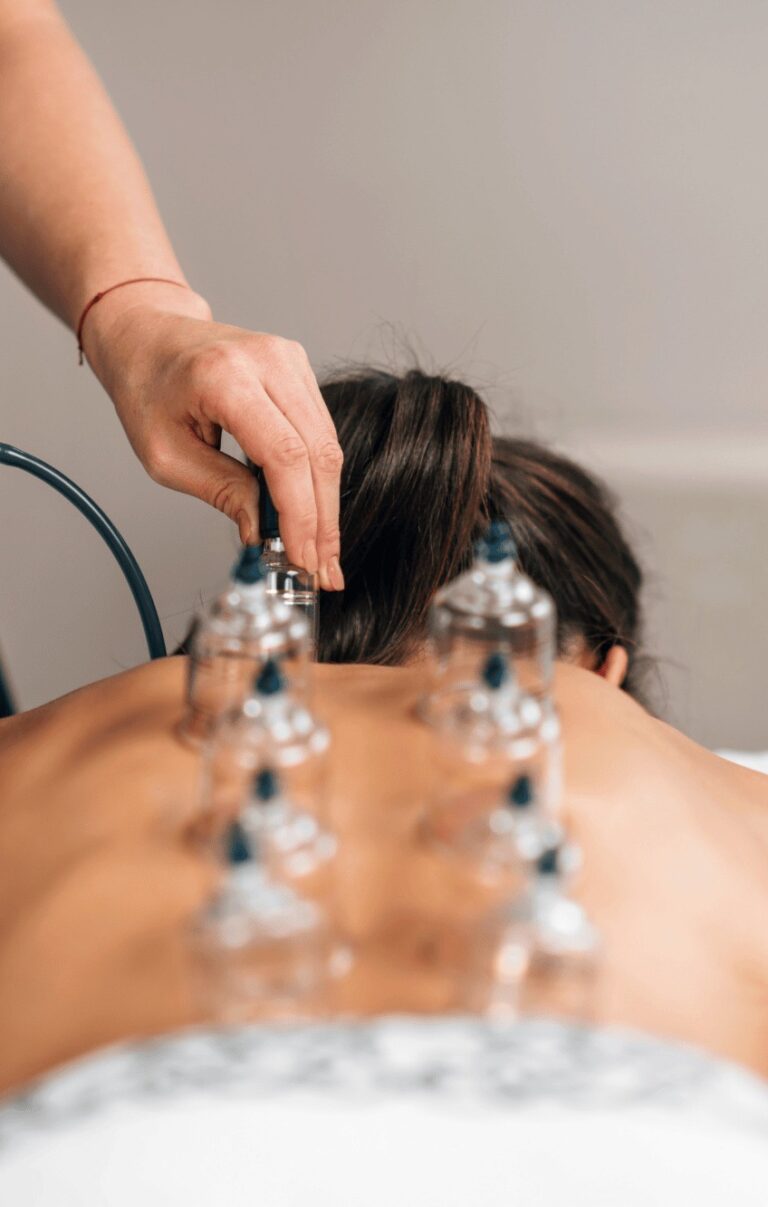 المحظورات بعد الحجامة: أهم 6 نقاط يجب تجنّبها بعد الجلسة!