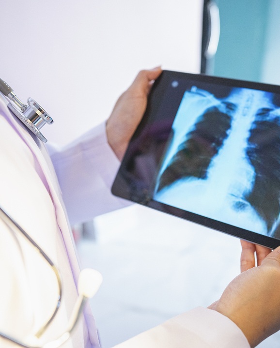 تعرفي على اخطر انواع السرطان حسب الإحصاءات الطبية العالمية!