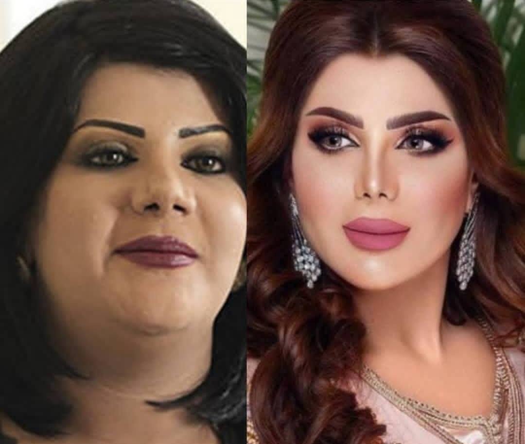 الهام الفضالة قبل وبعد التخسيس