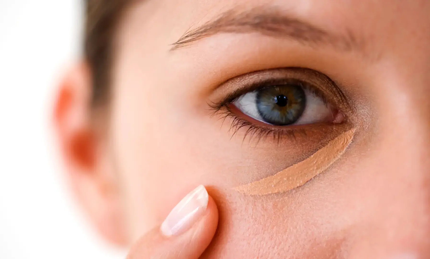 حفرة تحت العين