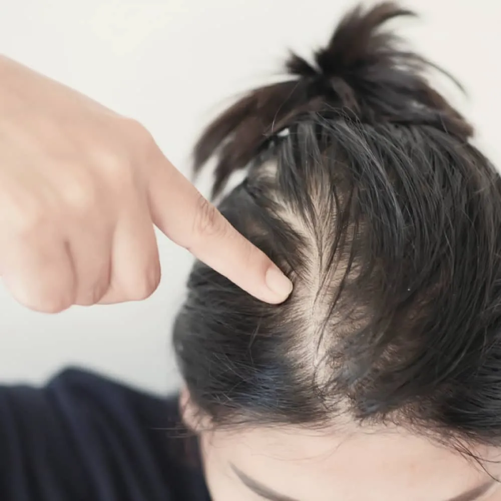 اسباب تساقط الشعر