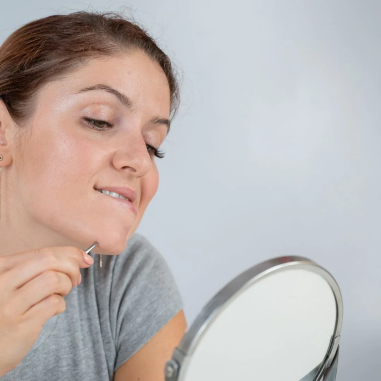 اليك طريقة إزالة الشعر تحت الجلد نهائيا تجربتي الخاصة!