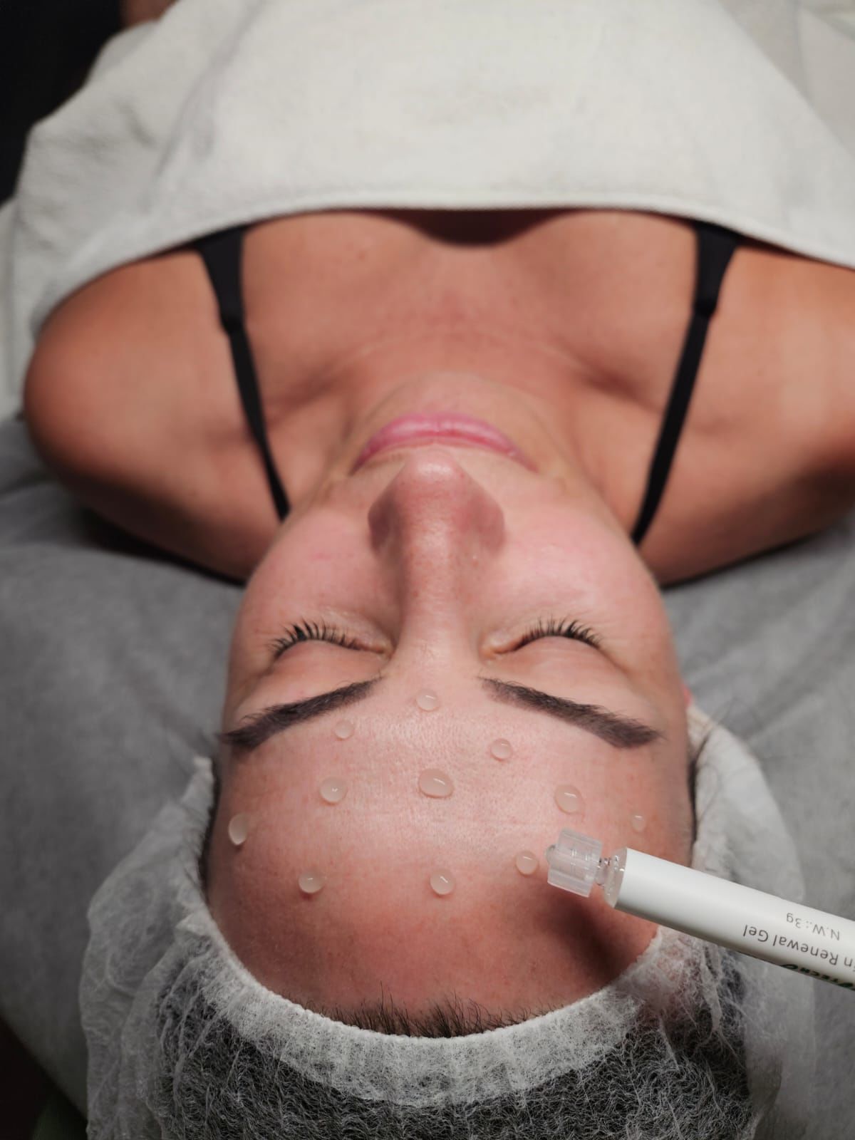 ابرة تنظيف البشرة لإزالة الشوائب المتراكمة داخل المسام