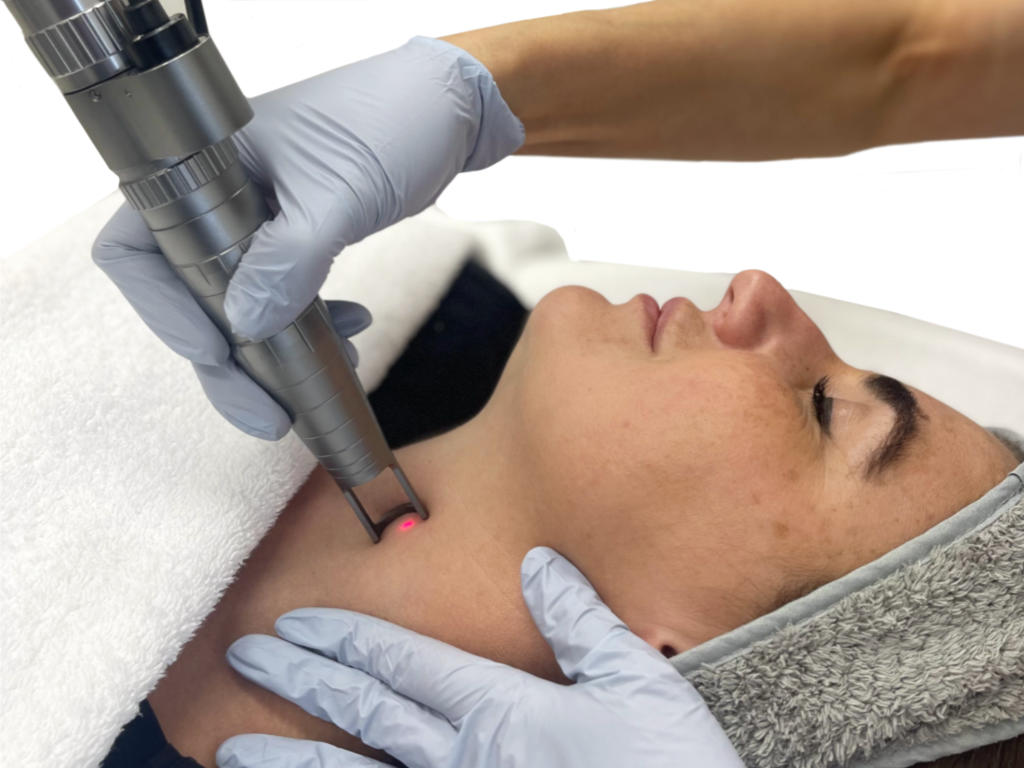 علاج تصبغات الرقبة