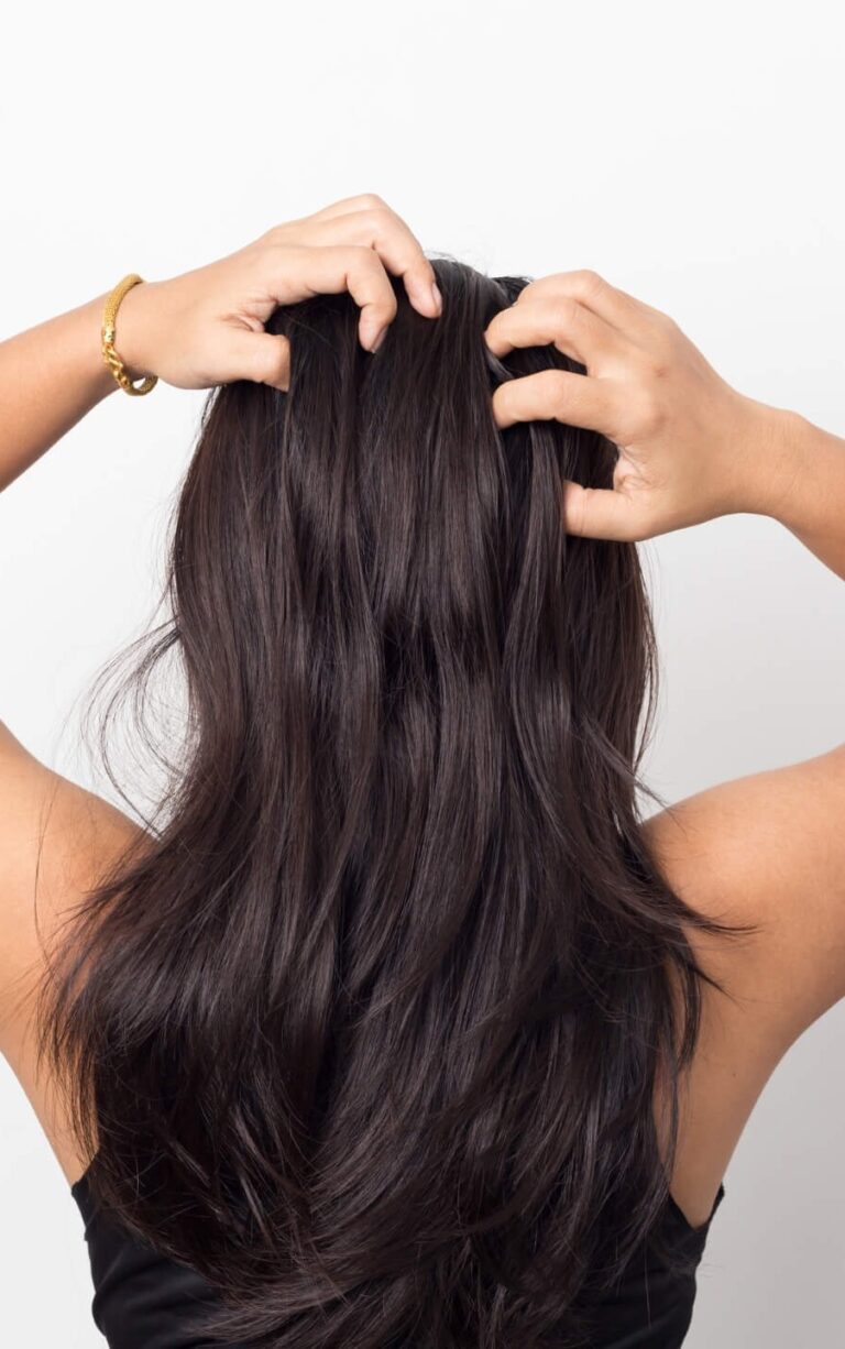 كيف اتخلص من حكة الراس؟