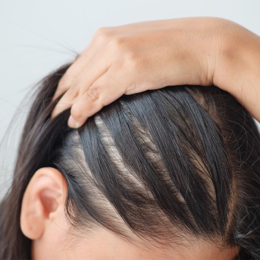 الحل النهائي لتساقط الشعر وتكثيفه